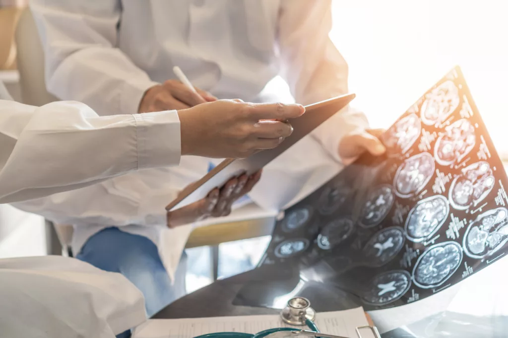 Le cancer du cerveau – explication