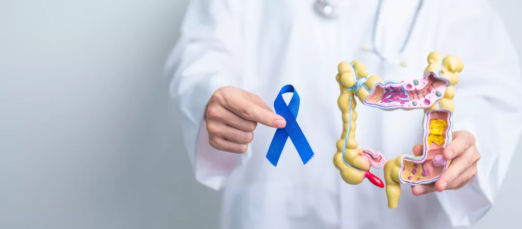 Lundi 11 mars – Journée de sensibilisation au cancer colorectal au CHU Charleroi-Chimay avec un côlon géant interactif