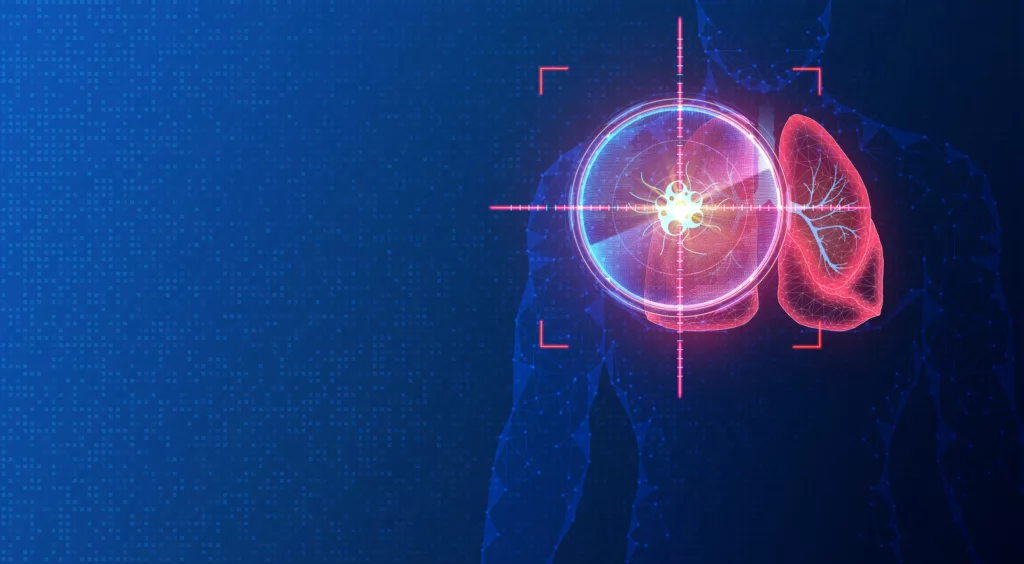 L&rsquo;intelligence artificielle pour accélérer la détection du cancer dans les hôpitaux limbourgeois