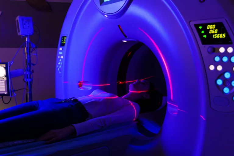 Innovation en radiothérapie : l&rsquo;apnée contrôlée au service de la précision